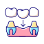 Dental Implant Icon